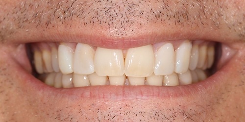 smile gallery image