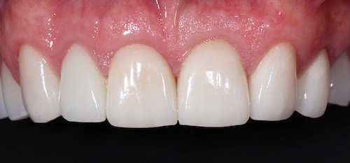 smile gallery image