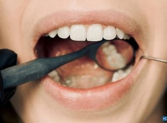 The effect of systemic drugs on the mouth