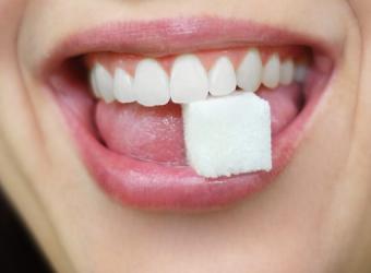 The role of Sugary and Acidic foods on the teeth
