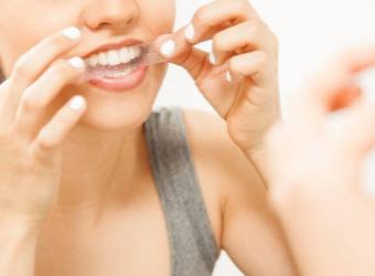 At-Home Teeth Whitening: Effective Options for a Brighter Smile